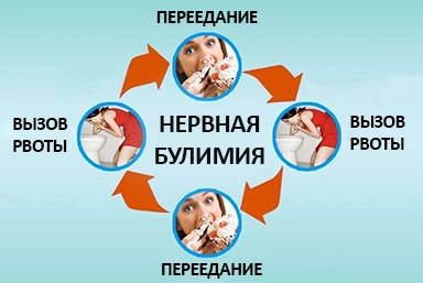 Лечение булимии в Черемушках
